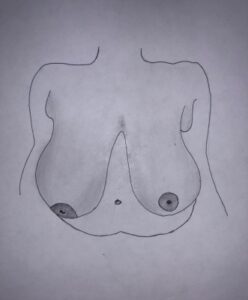 Breast