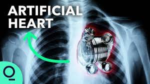 Artificial heart