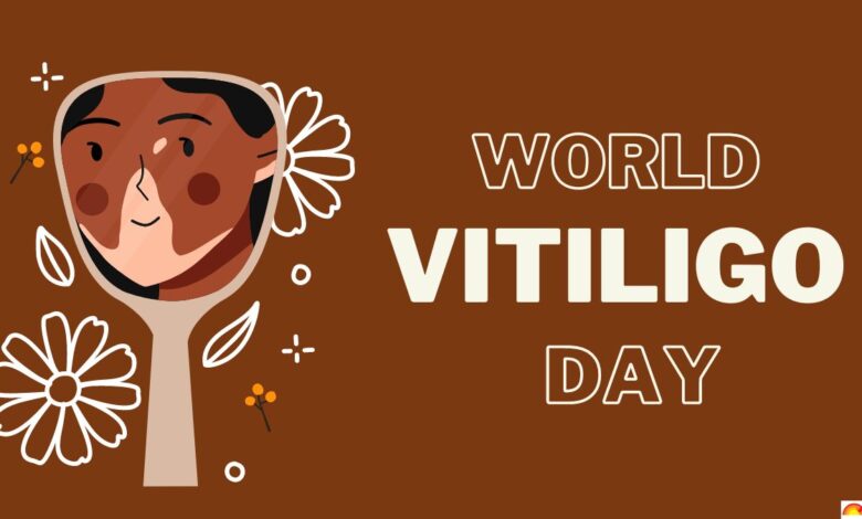 World Vitiligo Day