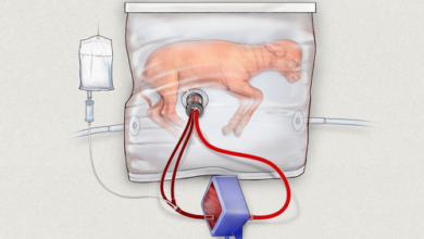 Artificial womb