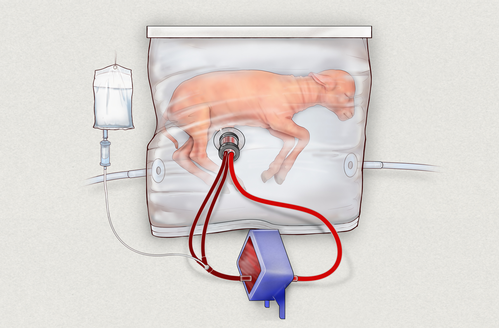 Artificial womb