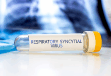 #RSVInfection #CardiacHealth #RespiratoryViruses #JAMANetwork #PublicHealthResearch