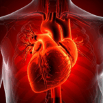 Heart diseases