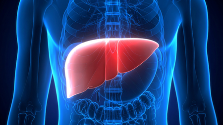 liver cirrhosis